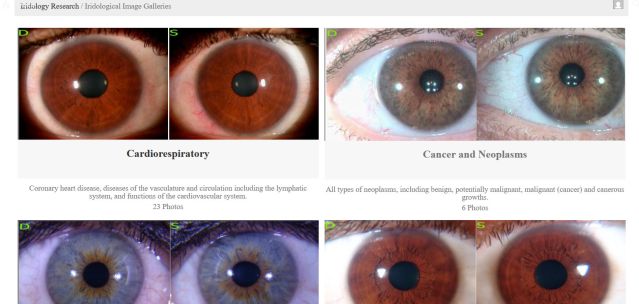 Case study gallery with paired right and left iris photographs grouped by body system, such as cardiorespiratory.