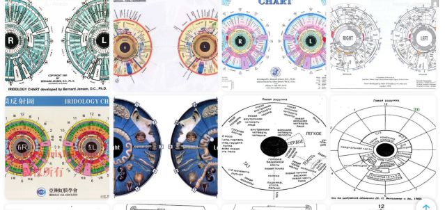 Gallery of iridology charts from American, Asian and Russian authors.