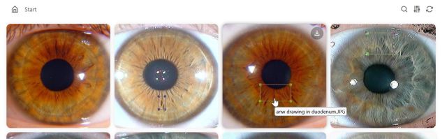 Iris sign gallery with annotated macro photographs.