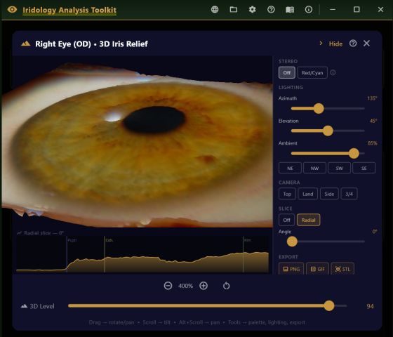 Three-dimensional relief view of a right iris with lighting and elevation controls.