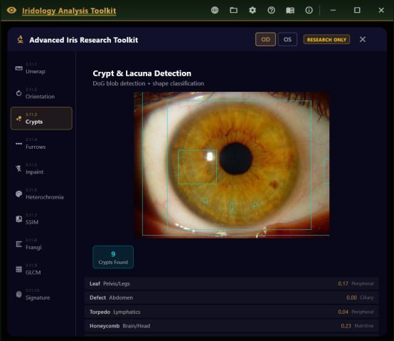 Advanced research toolkit running crypt and lacuna detection on an iris photograph.
