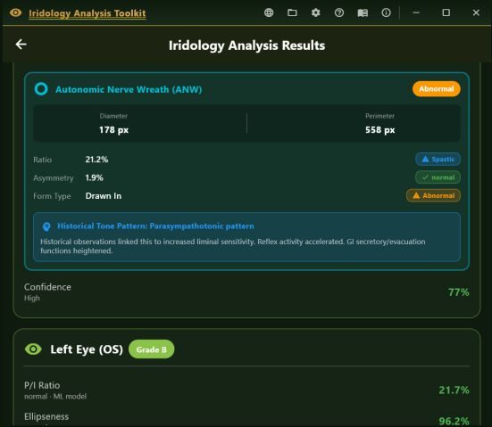 Autonomic nerve wreath analysis with diameter, ratio and asymmetry measurements and a pattern note.