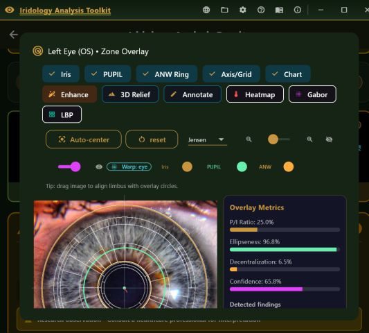 Toolkit zone overlay on a left iris, with toggles for pupil, collarette ring, chart, enhancement, 3D relief and heatmap, and overlay metrics.