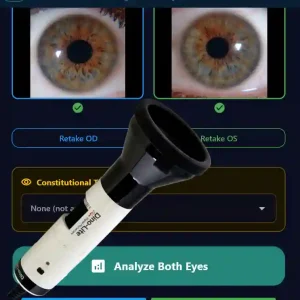 DinoLite Iriscope USB